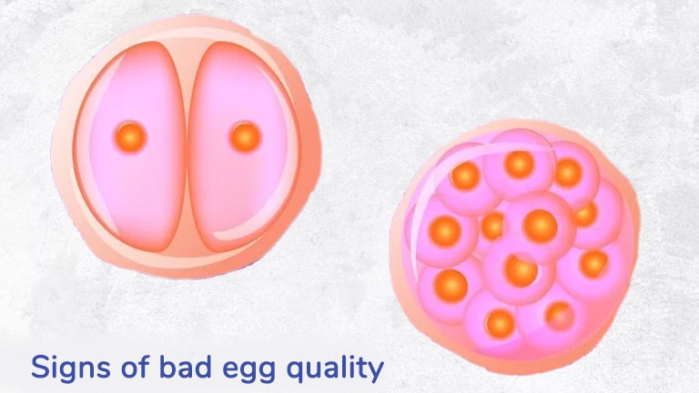 Signs Of Poor Egg Quality