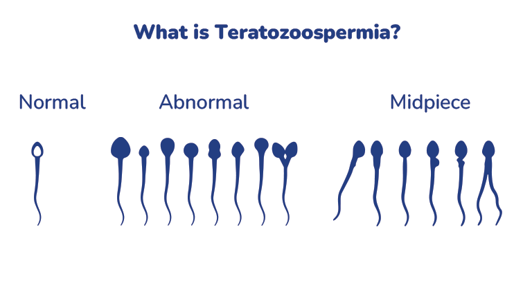 What is Teratozoospermia